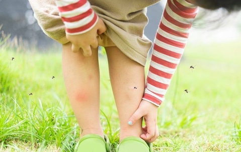 Kid's leg with mosquito bites
